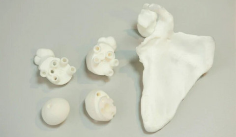 Quel est le rôle de l'impression 3D en chirurgie orthopédique et traumatologique ? - 3Dnatives